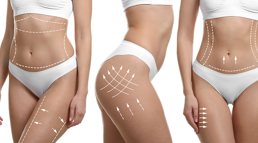 lipo 1